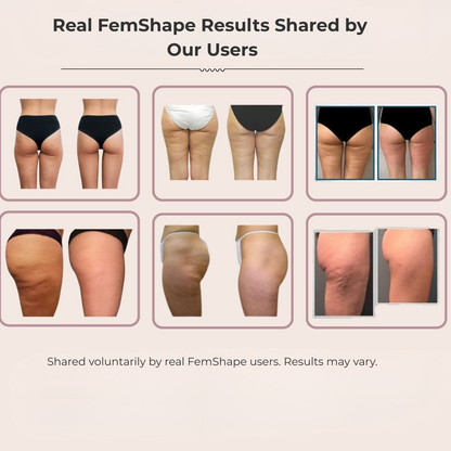 FemShape™ — Body Sculpt Shaper