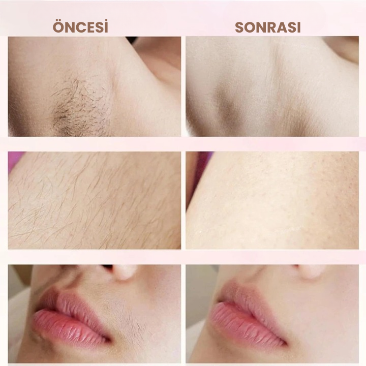 Tahrişsiz, Batıksız ve Pürüzsüz Tıraş – FemSilk™